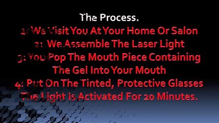 Teeth Whitening Sunderland, Gateshead, Newcastle, Hartlepool, Middlesbrough, Stockton, Darlington (mp4 480p)