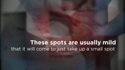 Morning Sickness Symptoms