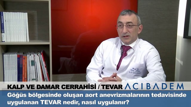 Göğüs bölgesinde oluşan aort anevrizmalarının tedavisinde uygulanan tevar nedir nasıl uygulanır ?