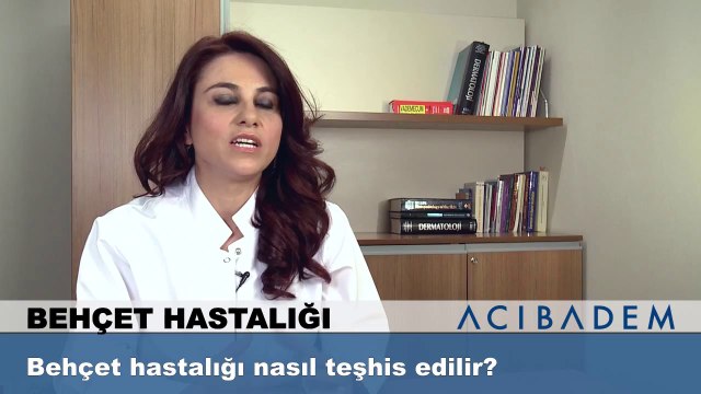 Behçet hastalığı nasıl teşhis edilir ?