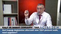 Aort kapağı değişimine alternatif olan tavi yöntemi nedir nasıl uygulanır?