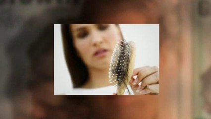 Receding Hairline Treatment