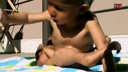 Un bébé avec 8 membres en Inde