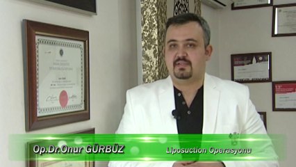 Doktor Onur Gürbüz Liposuction