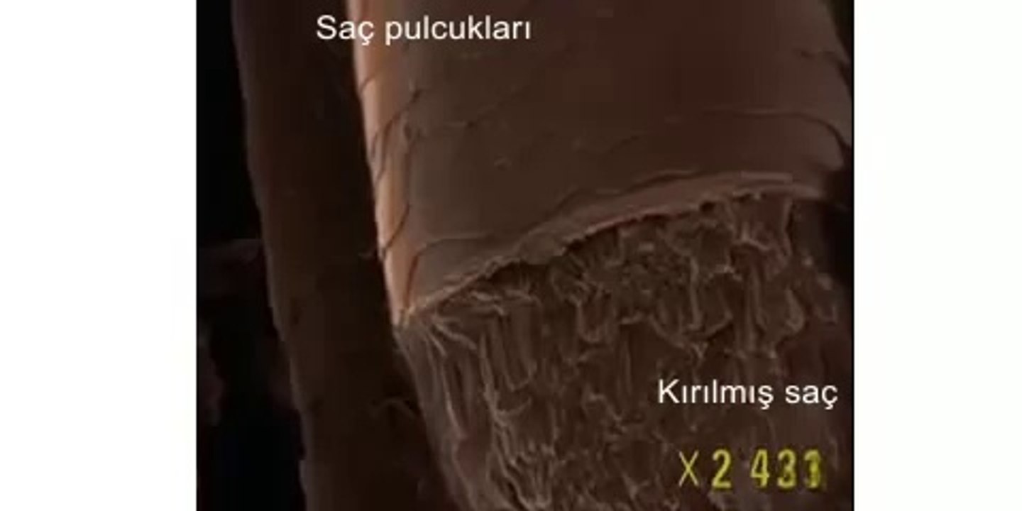 Saç Botoks