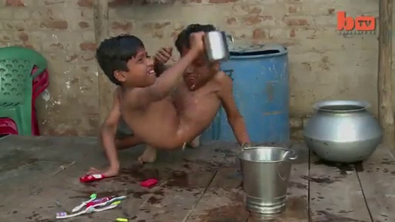 Two Brothers Joined Each other