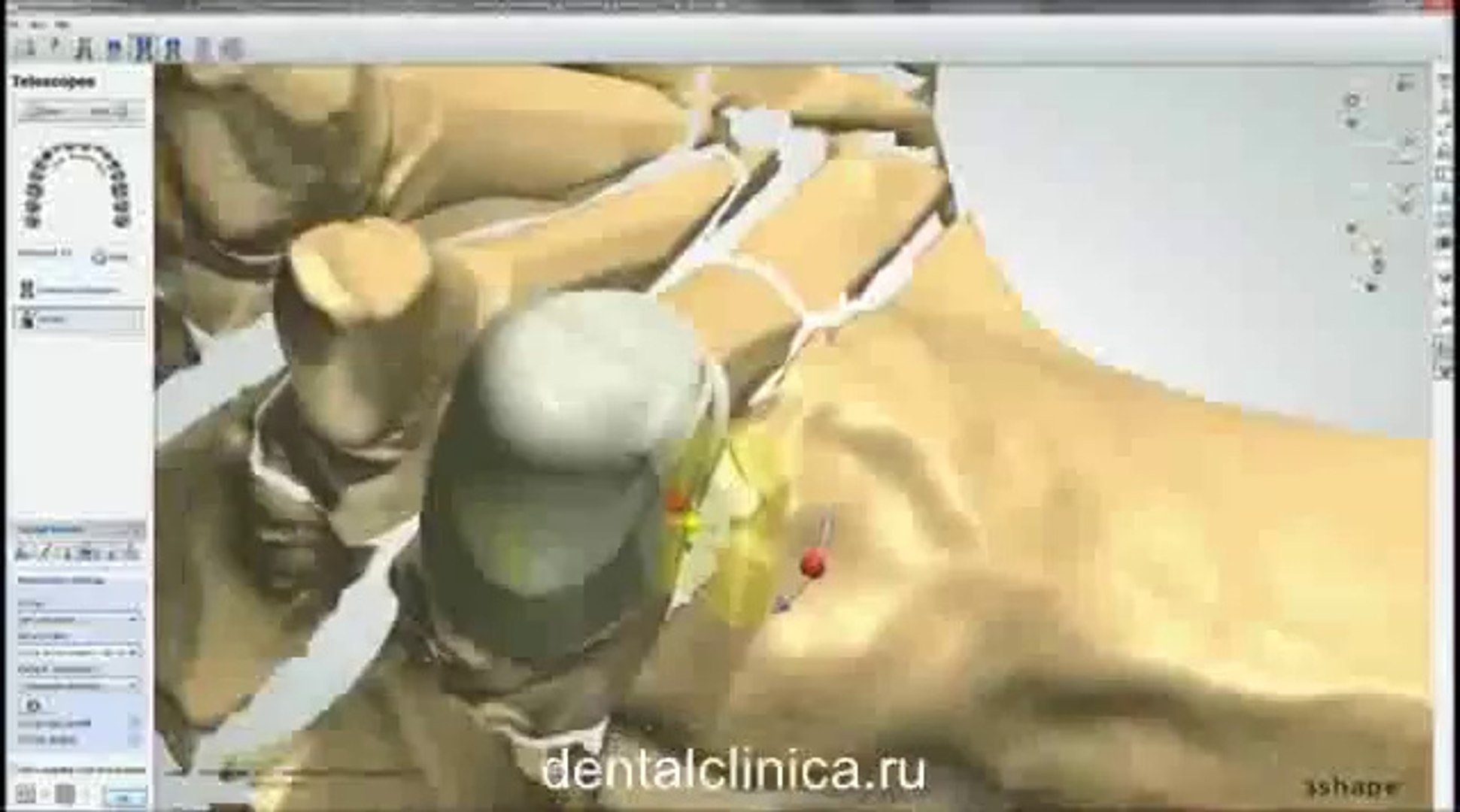 ⁣Клиника Имплантологии и Эстетической Стоматологии Моделирование 3Dshape Dental System Протезирование