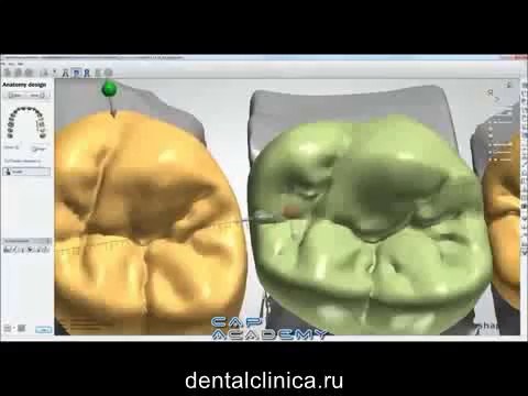 Центр Имплантологии и Ресторативной Стоматологии Моделирование 3Shape в стоматологии протезирование European Clinic of Aesthetic Dentistry