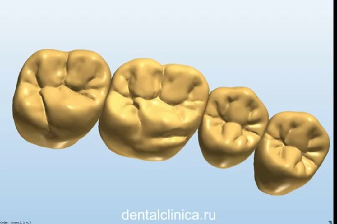 Центр Имплантологии и Ресторативной Стоматологии Презентация hi-tech 3D моделирование протезирование европейское качество