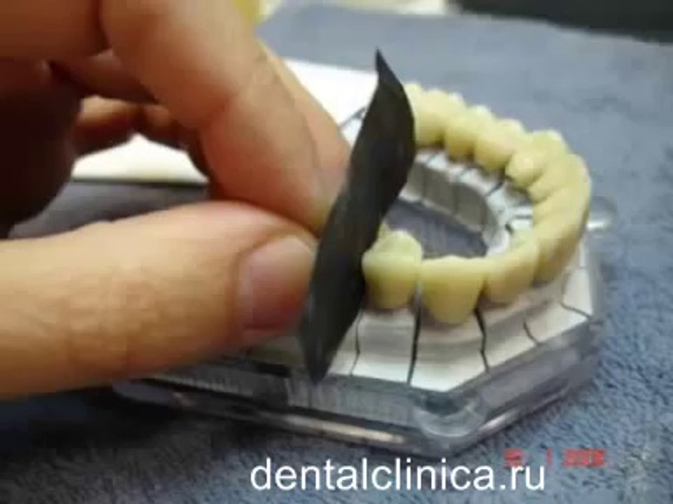 Клиника Имплантологии и Эстетической Стоматологии Презентация- Hi-Tech Ceramics Dental Lab Стоматология протезирование инновации