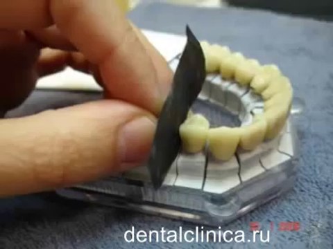 Клиника Имплантологии и Эстетической Стоматологии Презентация- Hi-Tech Ceramics Dental Lab Стоматология протезирование инновации