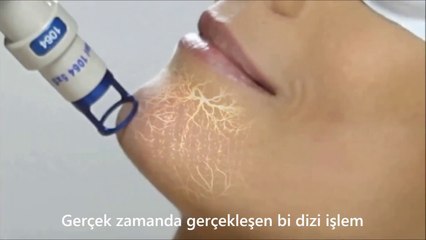 ClearLift Estetik Lazer Dr Mustafa Karataş