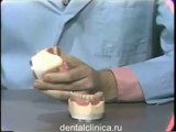 Протезирование, изготовление полного протеза, уроки мастерства в Клинике стоматологии European Clinic of Aesthetic Dentistry in Budapest “Jewel Dental” “AVANTE” Dentist Medical Center