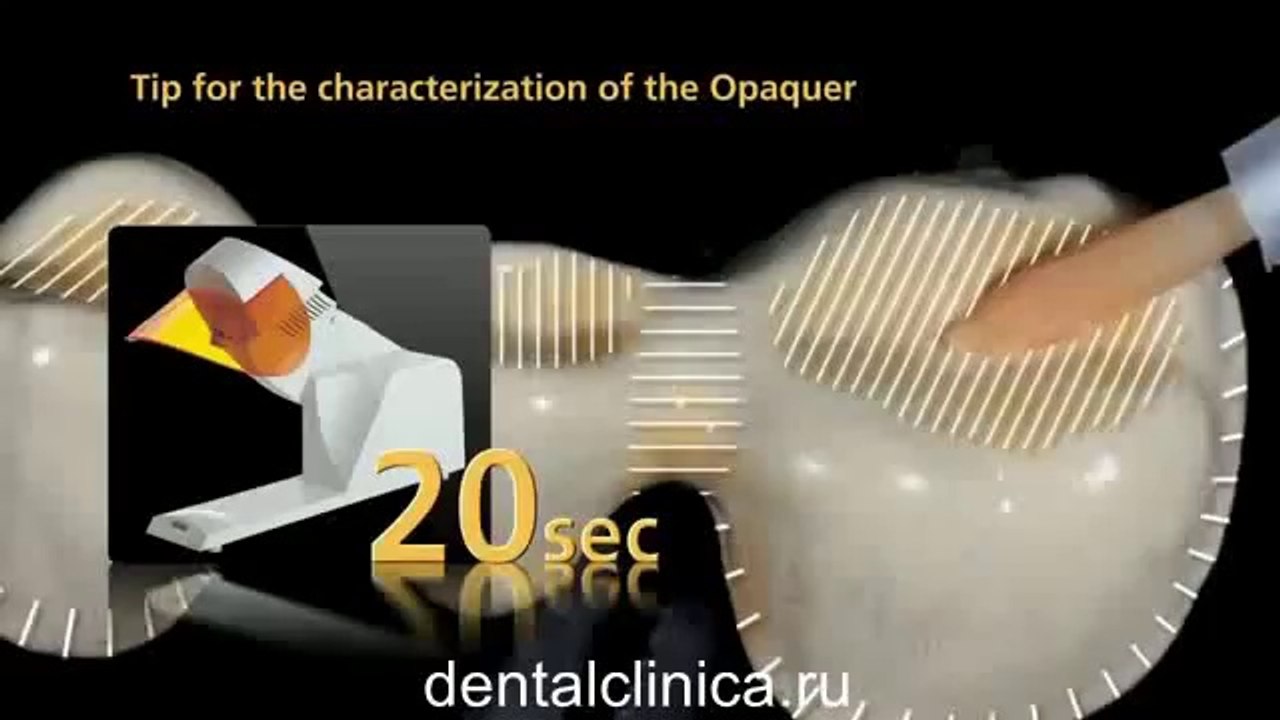 Реставрационная стоматология, протезирование SR Nexco система металлокерамика Клиника Имплантологии и Эстетической Стоматологии