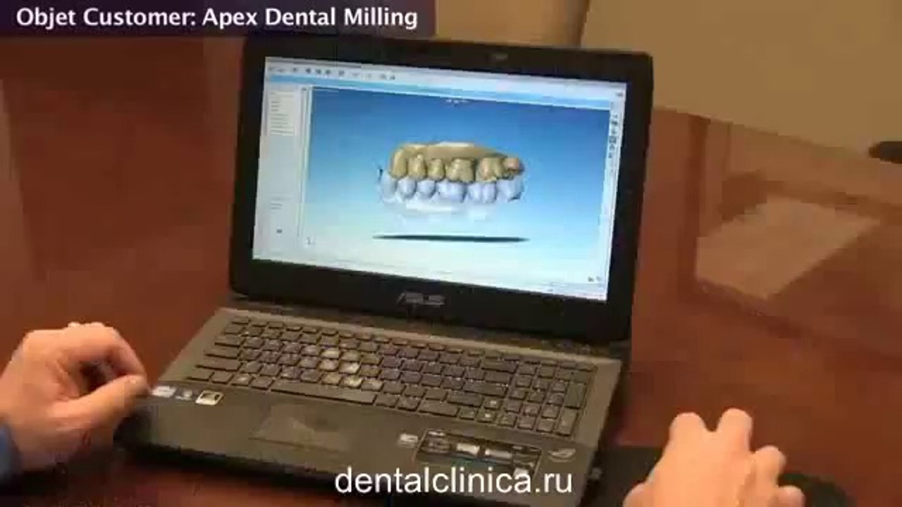 Семинар преимущество 3D Printing hi-tech в протезировании и лечении зубов Имплантация протезирование лечение зубов красиво доступно порадуйте мир улыбкой