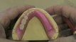 European Clinic of Aesthetic Dentistry in Budapest “Jewel Dental” “AVANTE” Dentist Medical Center Семинар по стоматологии, лечение зубов, справочный материал, видео обучение