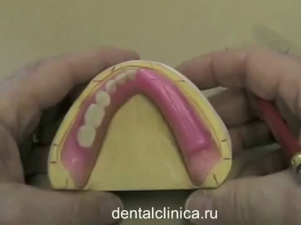 European Clinic of Aesthetic Dentistry in Budapest “Jewel Dental” “AVANTE” Dentist Medical Center Семинар по стоматологии, лечение зубов, справочный материал, видео обучение