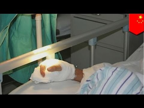 Woman discovers husband is having affair only to have finger bitten off by mistress