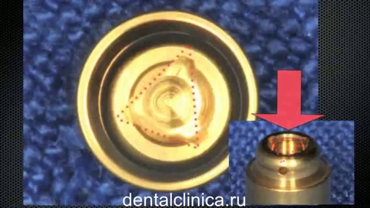 Семинар протезирование зубов на имплантах в European Clinic of Aesthetic Dentistry in Budapest “Jewel Dental” “AVANTE” Международная клиника стоматологии имплантологии