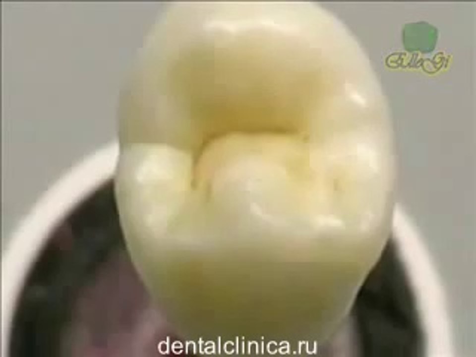 Семинар Эстетическая стоматология зубы из керамики hi-tech качество "denti natural" European Clinic of Aesthetic Dentistry in Budapest “Jewel Dental” “AVANTE”