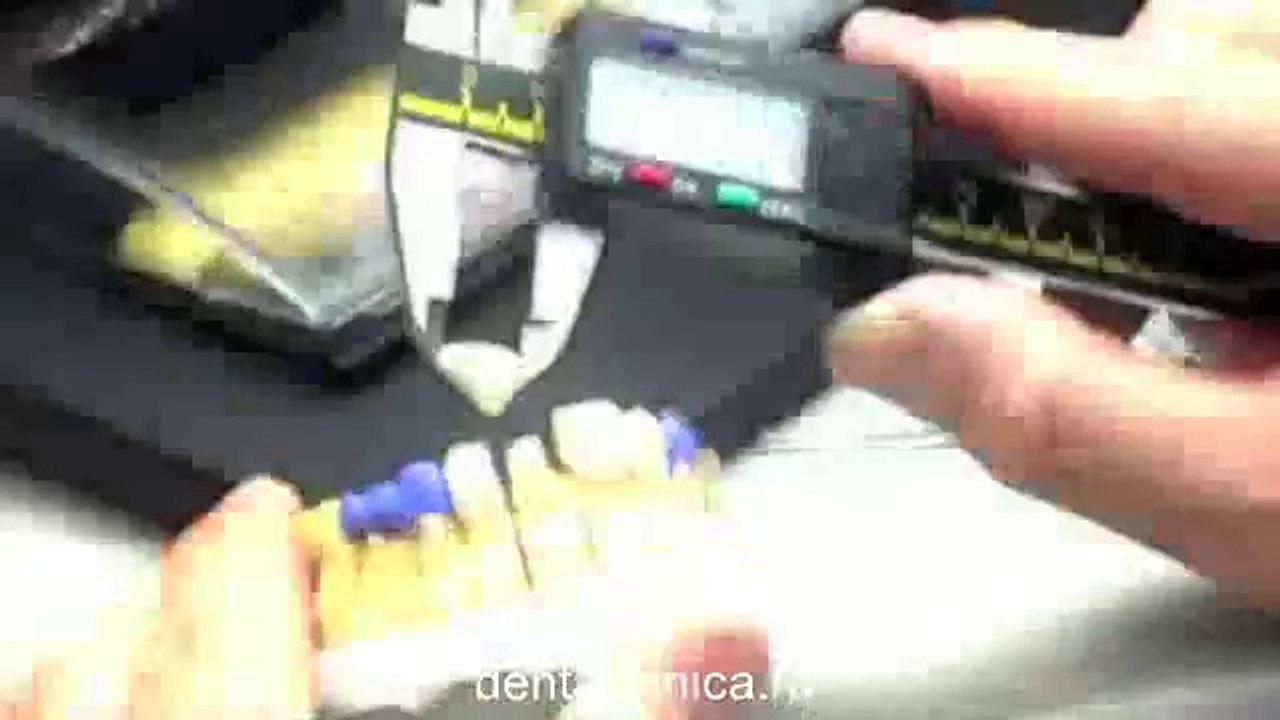 European Clinic  Dentistry in Budapest Jewel Dental AVANTE Dentist Medical Center Эстетическая стоматология, создание нового керамического покрытия, видео урок Центр Имплантологии и Ресторативной Стоматологии