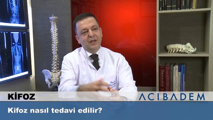 Kifoz nasıl tedavi edilir?