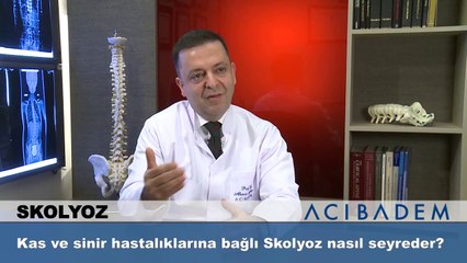 Kas ve sinir hastalıklarına bağlı Skolyoz nasıl seyreder?