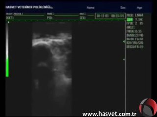 Wed 3000 Ultrason Görüntüsü - Hasvet Medikal