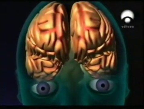 Amnesia anterograda: Encefalitis herpetica (Clive Wearing)