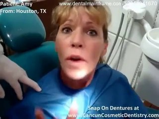 Implant Retained Dentures - Mini Dental Implant Dentures - Snap On Dentures_(new)