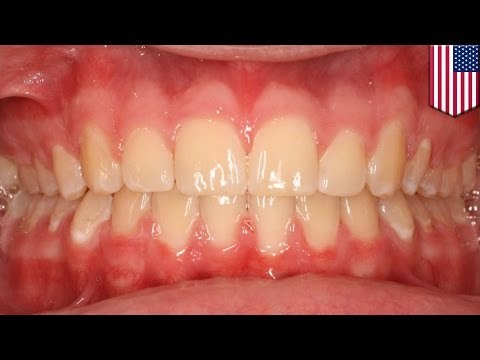 Disgusting! Mother BITES OFF umbilical cord after going on crack binge, giving birth in bathtub