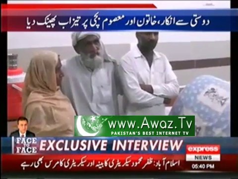 Lodhran - Man threw acid on woman face for not accepting friendship request