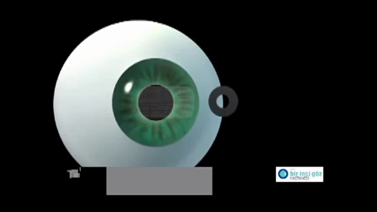 Bir İnci Göz - Kamra Inlay Animasyonu