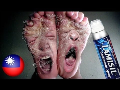 Athlete's foot itches like hell! Woman steals foot spray from pharmacy