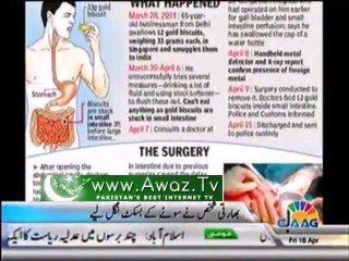 India - Doctors find 12 gold biscuits in a man's Stomach