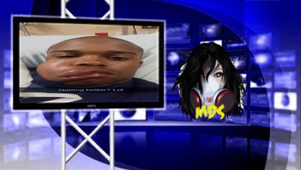 DeShields Jr. took a fastball to the face Full Video