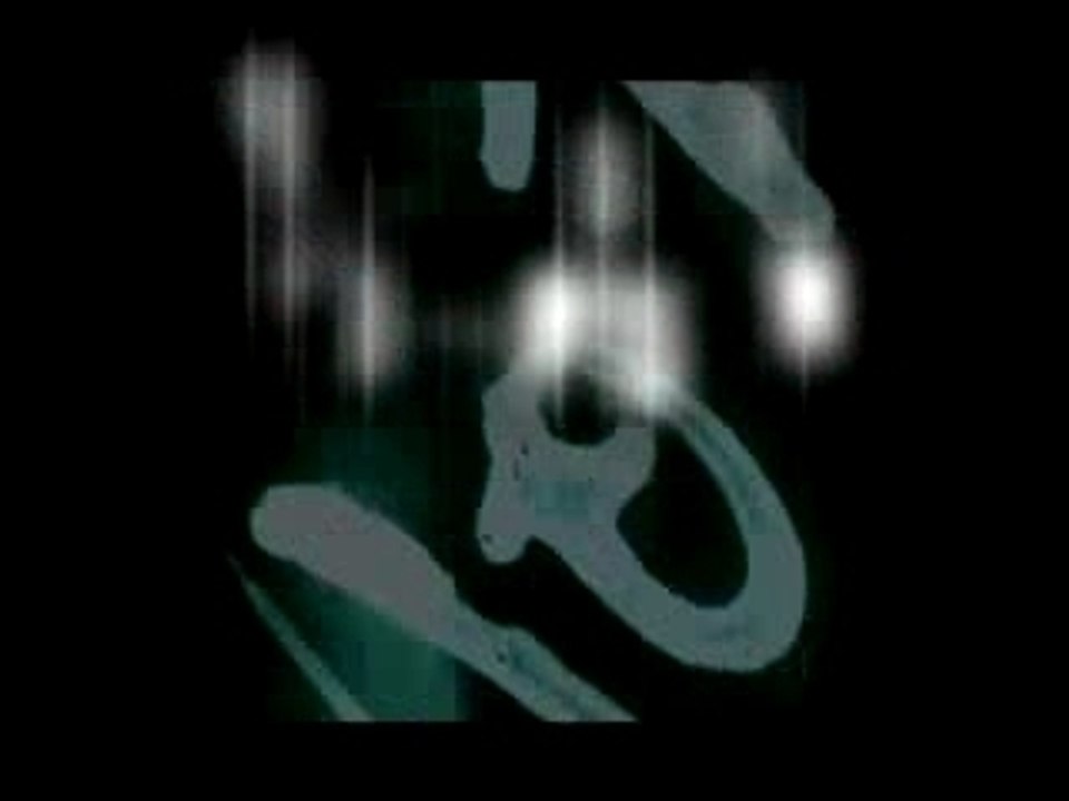 Teaser_giz