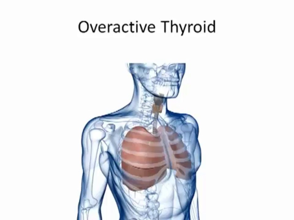 How To Not Sweat, How To Stop Sweating Underarms, Sweating For No Reason, Sweaty Girl Feet