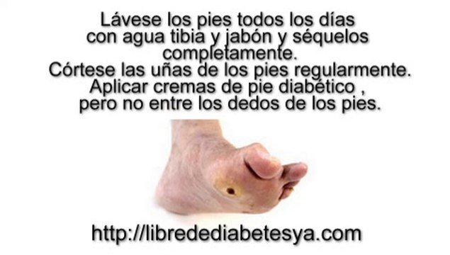 Pie diabetico sintomas - Libre de diabetes