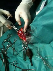 Kırık Kemik Operasyonu 2