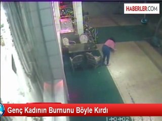 Genç Kadının Burnunu Böyle Kırdı