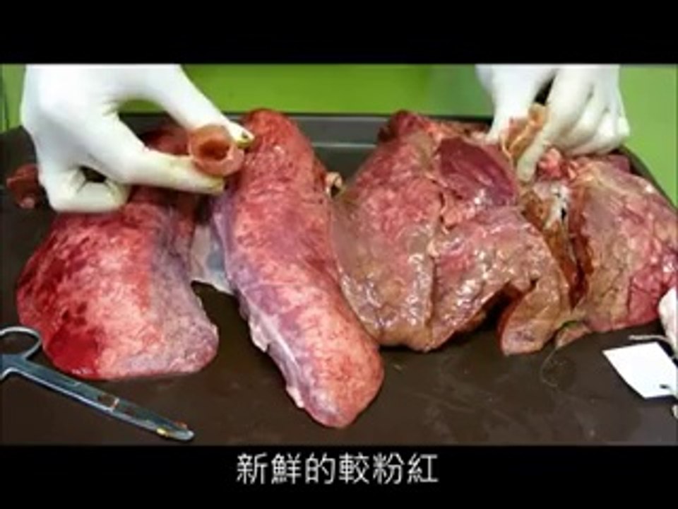 Smoking Lung – All Smokers Must Watch!