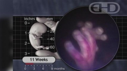 Pregnancy: What to Expect Week 11