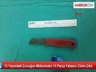 Zihinsel Gengelli Gencin Midesinden Kalem, Kaşık Gibi 16 Parça Çıktı