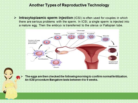 ICSI Procedure Could Help With Infertility Problem