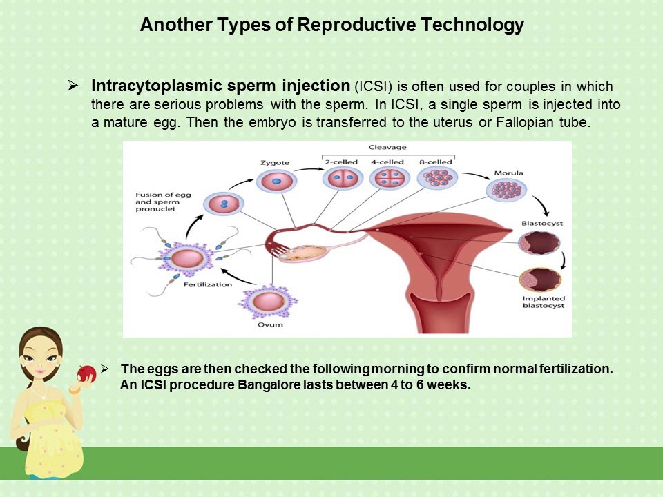 ICSI Procedure Could Help With Infertility Problem