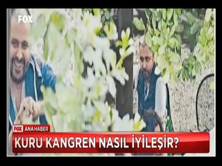 Nejat İşler'in parmakları niye simsiyah?
