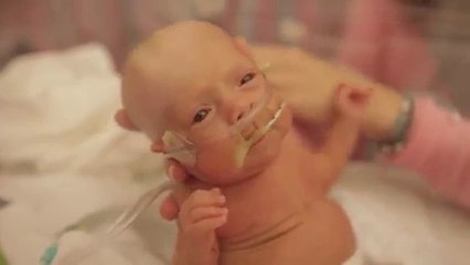 Minik savaşçının bir yıllık mucize öyküsü