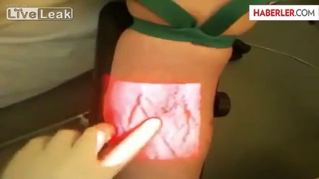 Acemi Hemşireler İçin Damar Bulma Cihazı