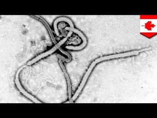 Canada has possible Ebola case